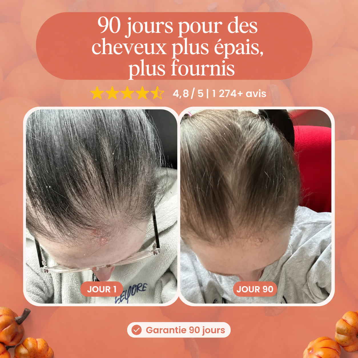 Gélules d’huile de graines de courge